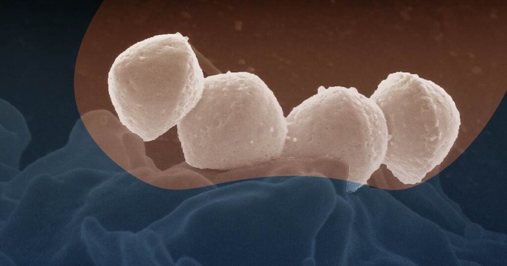 Streptococcus Pyogenes Microscopic Photo for This Medical Life Episode