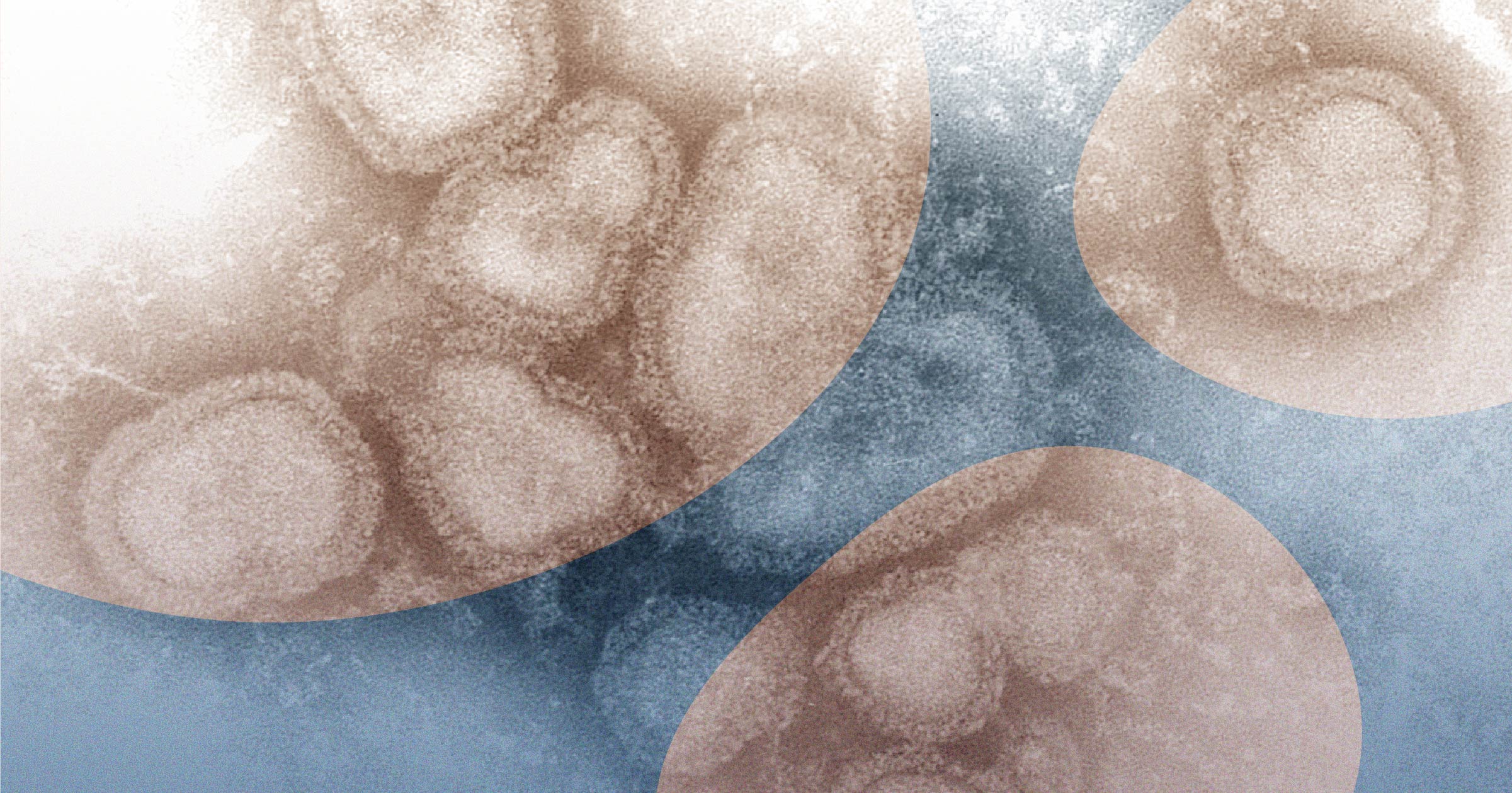 electron microscopic image depicting a Influenza A virions