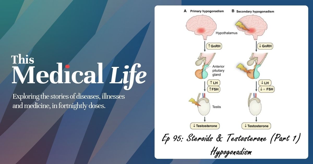 Episode 95: Steroids & Testosterone (Part 1) | Male Hypogonadism