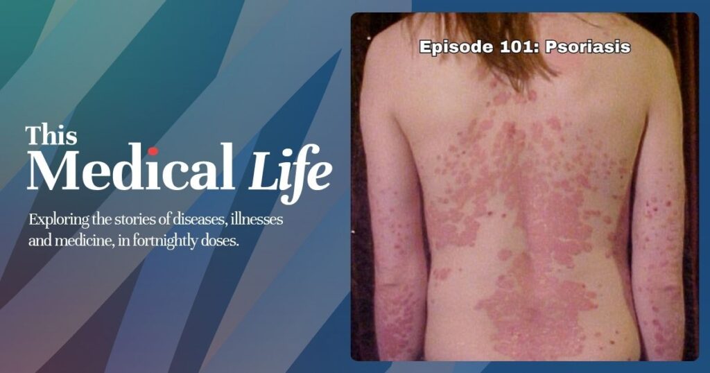 Episode 101: Psoriasis | Skin, Immunity, And The Marks We Carry