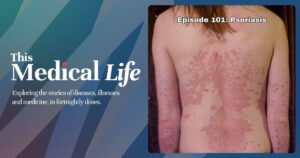 Episode 101: Psoriasis | Skin, Immunity, And The Marks We Carry
