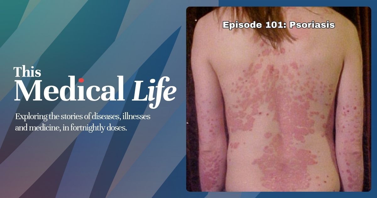 Episode 101: Psoriasis | Skin, Immunity, And The Marks We Carry