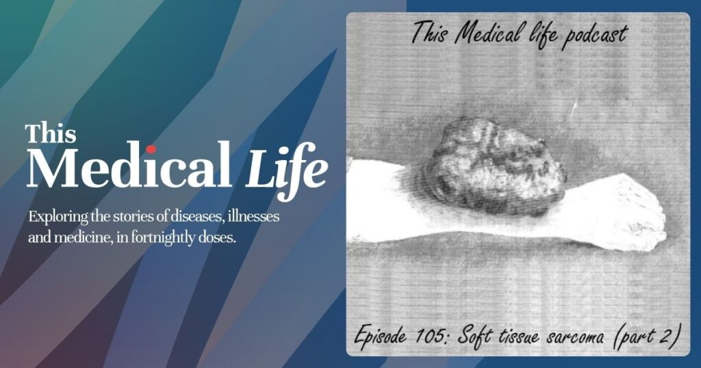 Episode 105: Soft Tissue Sarcoma Part 2 | Adjuvant Therapies