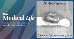 Episode 105: Soft Tissue Sarcoma Part 2 | Adjuvant Therapies
