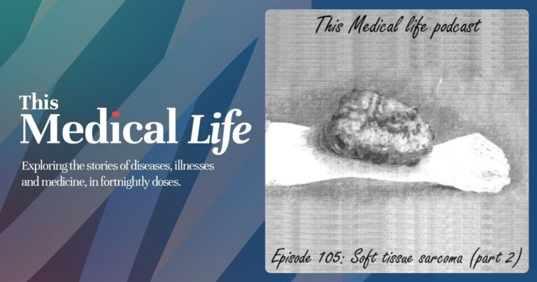 Episode 105: Soft Tissue Sarcoma Part 2 | Adjuvant Therapies