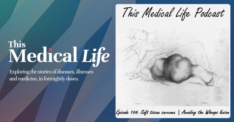 The whoops lesion Ep 104: Soft tissue sarcoma (part 1) | Avoiding the whoops lesion