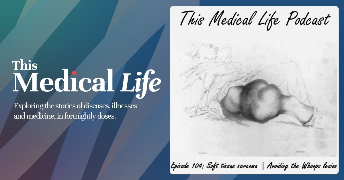 Ep 104: Soft tissue sarcoma (part 1) | Avoiding the whoops lesion