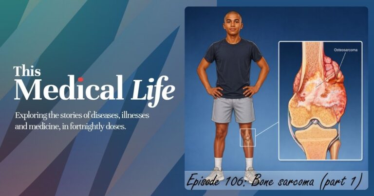 TML 106 bone sarcoma Episode 106: Bone Sarcoma Part 1 | Osteosarcoma, Chondrosaroma & Ewing Sarcoma