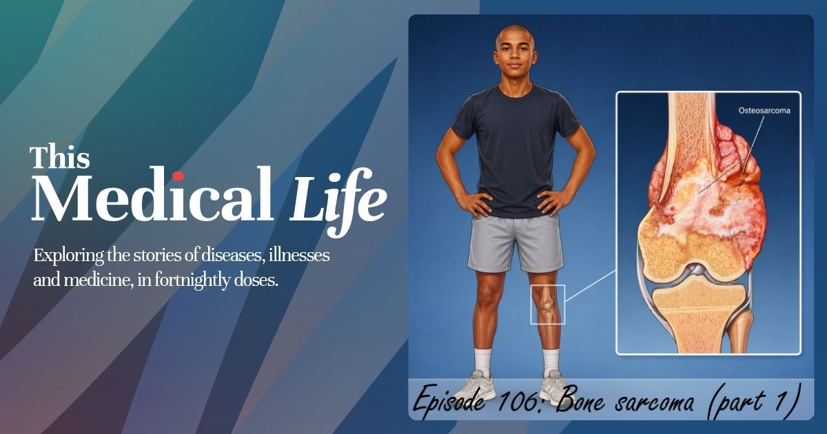 Episode 106: Bone Sarcoma Part 1 | Osteosarcoma, Chondrosaroma & Ewing Sarcoma