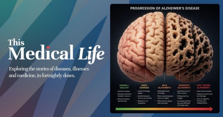 S07E108 Alzheimers Episode 108: Alzheimer’s Disease | Auguste Deter’s Decline